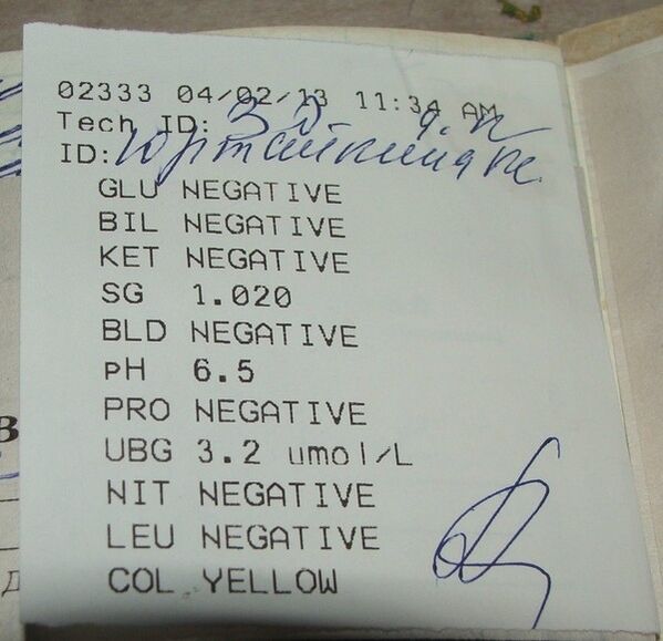 Моят анализ на урината води до фемиксал